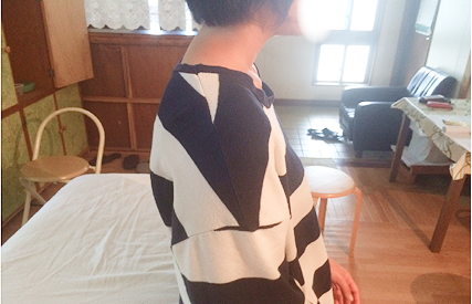 猫背調整ビフォー