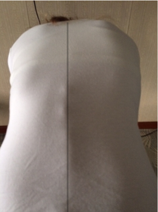 背骨調整アフター